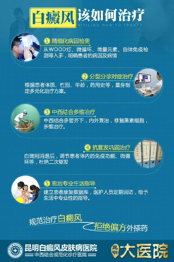 白癜风该如何治疗?